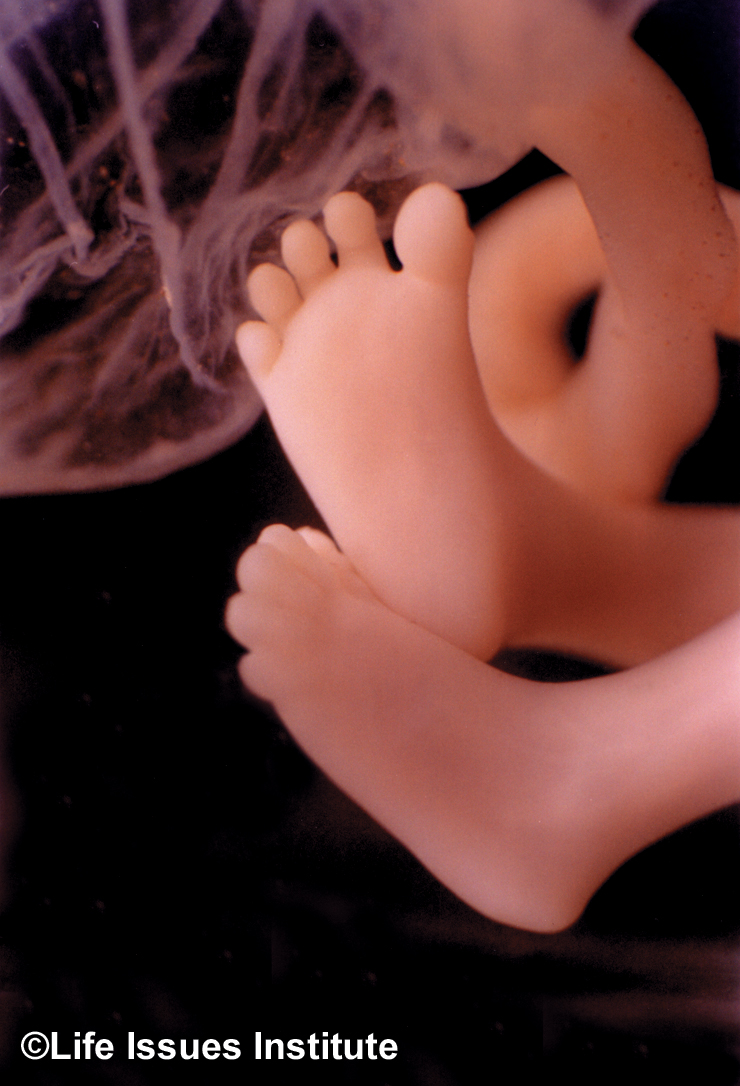 12 week Fetal Feet