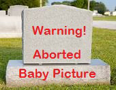 Aborted Babies
